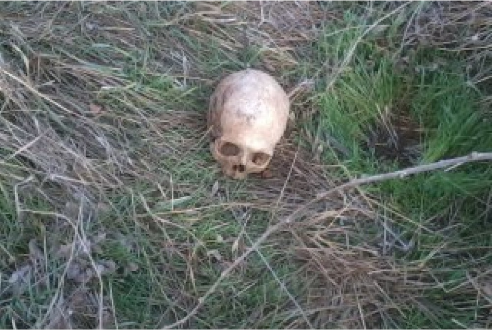 В полиции опровергли информацию о том, что оставили череп и кости в парке «фото»
