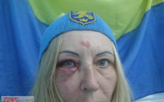 Волонтер из Котовска рассказала, как ее избивал неадекватный военный (фото) «фото»