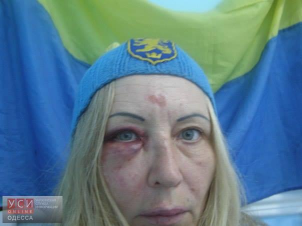 Волонтер из Котовска рассказала, как ее избивал неадекватный военный (фото) «фото»