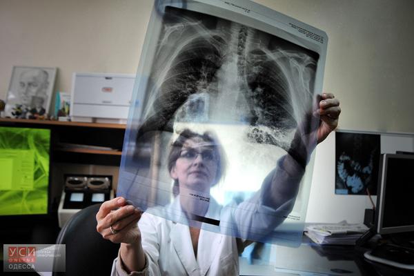 В Одесской области разгуливает туберкулез «фото»