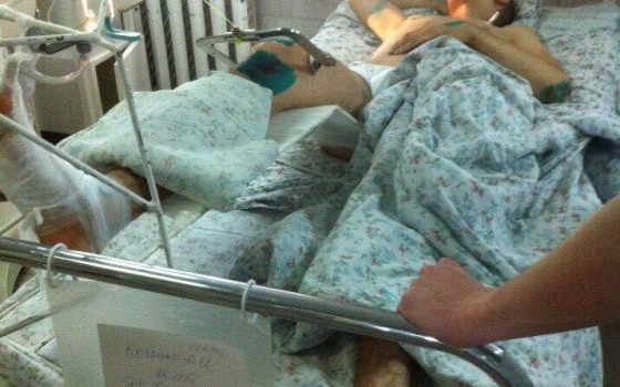Парень, попавший под трамвай в Одессе, пробудет в больнице полгода: у него сломан позвоночник «фото»