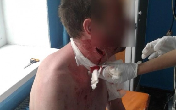 Житель Одесской области посреди улицы перерезал себе горло (фото) «фото»