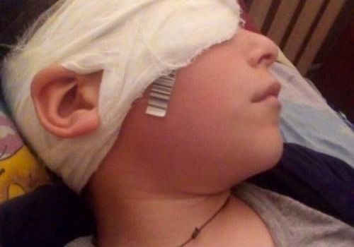 Трагедия в Измаильском районе: мальчику одноклассник проткнул глаз ручкой «фото»