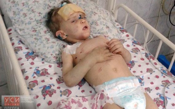 В Одессе найден мальчик, который ничего о себе не помнит «фото»