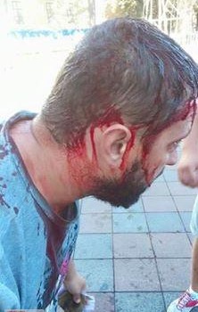 Активисты «РГБ», «Автомайдана» и «Самообороны» напали на Антитрухановский майдан (фото) «фото»