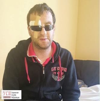 Одесские офтальмологи провели сложнейшую операцию по пересадке роговицы ветерану АТО «фото»