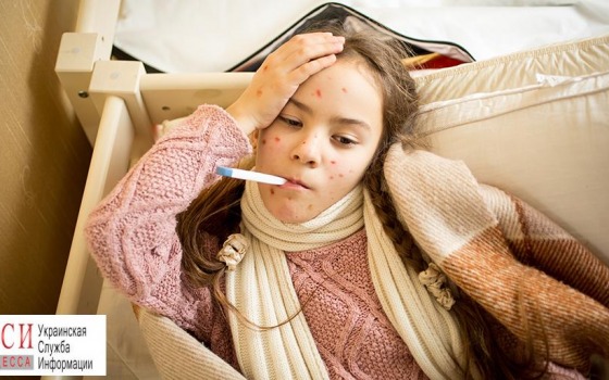 Число заболевших корью в Одессе стремительно растет «фото»