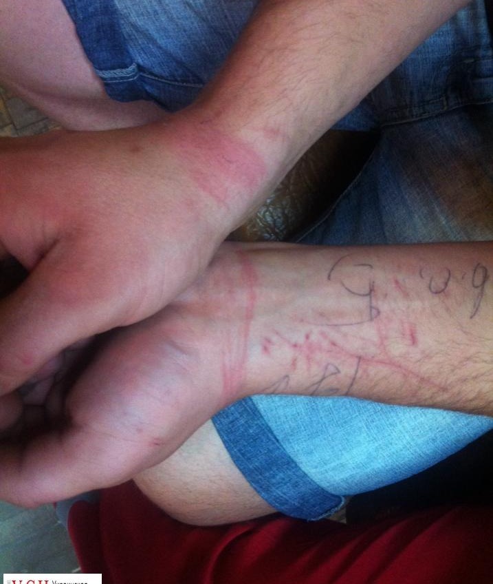 Патрульные избили туриста за сделанное замечание – одесский активист «фото»