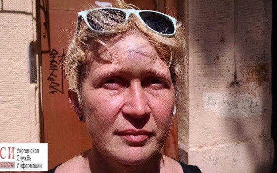 Полиция расследует сегодняшнее нападение на одесскую активистку «фото»