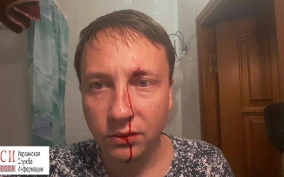В Черноморске избили депутата городского совета (фото) «фото»
