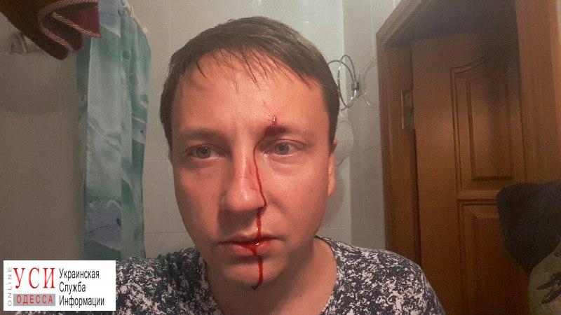В Черноморске избили депутата городского совета (фото) «фото»