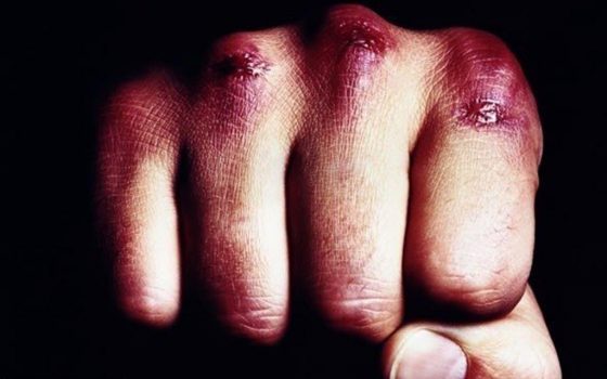 Смертельная дедовщина: в Одесской области солдаты забили насмерть сослуживца «фото»