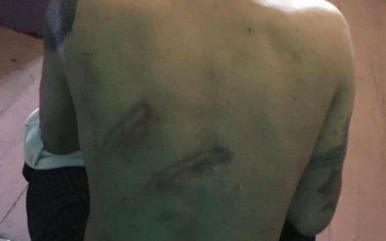 Представители Верховной Рады приедут разбираться с пытками в Одесском СИЗО «фото»