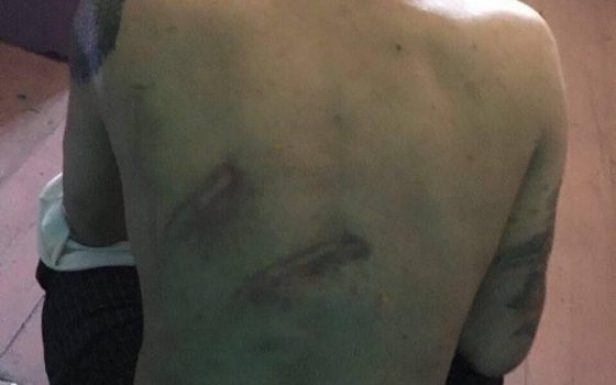 В Одессе взялись за расследование фактов жестокого обращения с заключенными (фото) «фото»