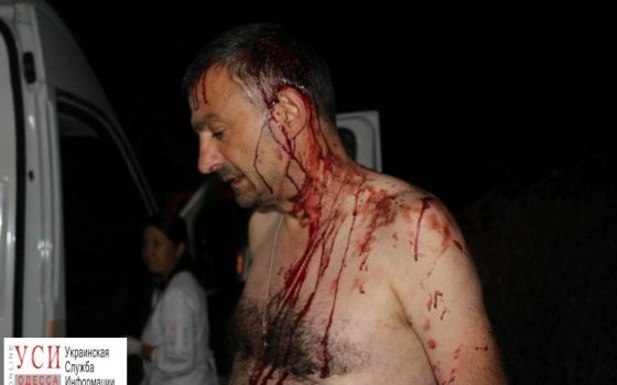 Совершено нападение на главреда овидиопольской газеты (фото, видео) «фото»