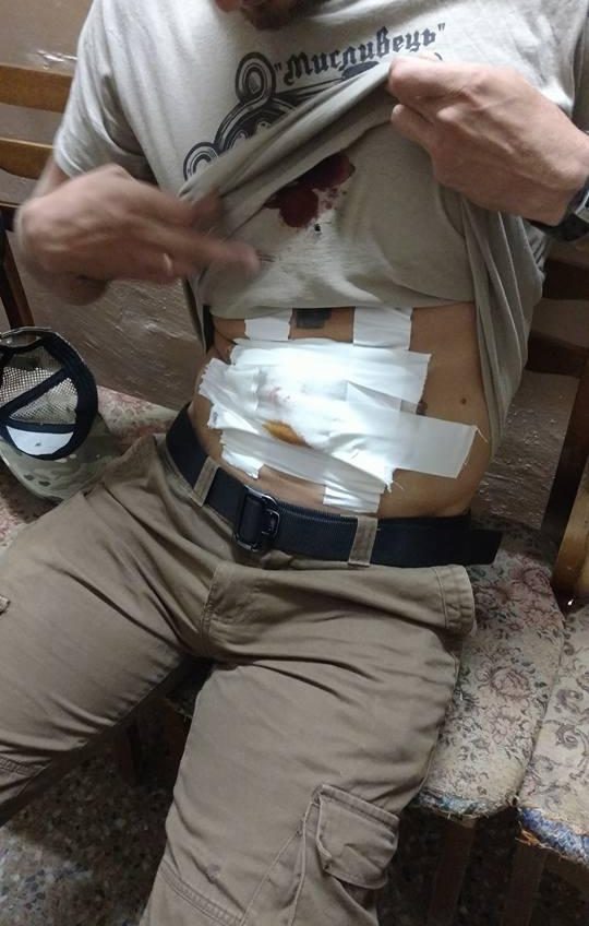 Ночью в Одессе стреляли в общественного активиста (фото) «фото»