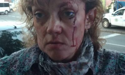 На одесскую активистку Алину Подолянку напали в центре города (фото, видео) «фото»