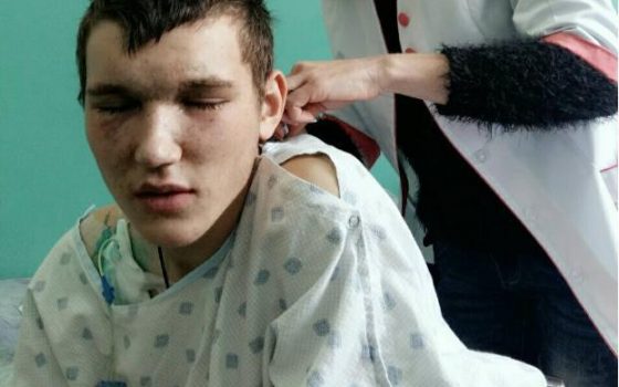 Одесских волонтеров просят помочь 18-летнему тяжелораненному в АТО сироте usionline.com Одесских волонтеров просят помочь 18-летнему тяжелораненному в АТО сироте «фото»