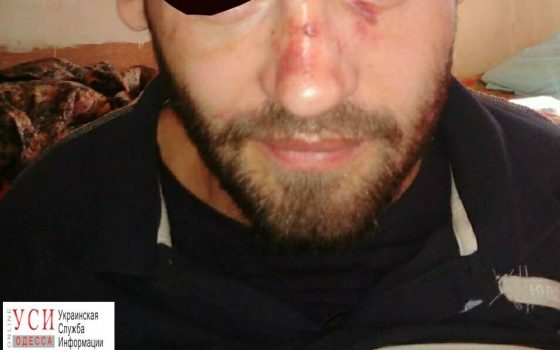 Трагедия на “этапе”: заключенный из одесского СИЗО в знак протеста пытался покончить с собой (фото) usionline.com Трагедия на “этапе”: заключенный из одесского СИЗО в знак протеста пытался покончить с собой (фото) «фото»