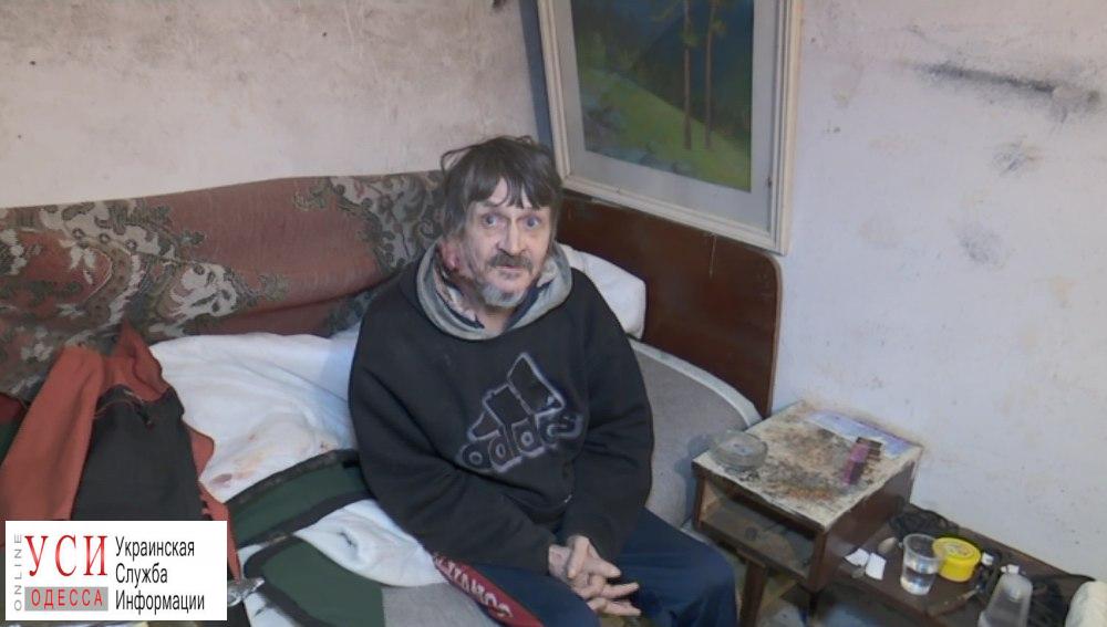 Одесские волонтеры взялись спасать жизнь бездомному моряку (фото) «фото»