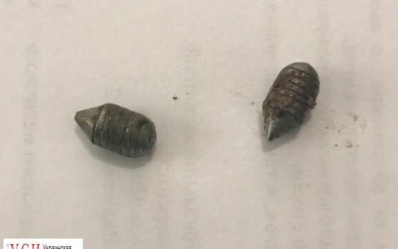 Врачи вытащили последнюю пулю из тела раненого на Новосельского полицейского «фото»