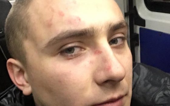 Неизвестные напали на активиста Стерненко у его дома (обновлено) «фото»