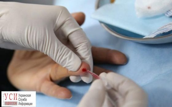 Одесситы могут бесплатно узнать свой ВИЧ-статус, потратив на это 15 минут «фото»