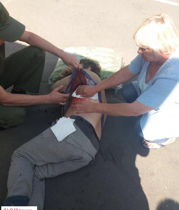 В Одессе неизвестный ранил одессита на пляже «фото»