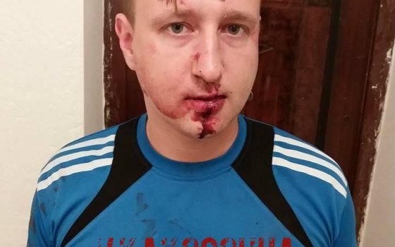 В Одессе неизвестные избили и ограбили журналиста usionline.com В Одессе неизвестные избили и ограбили журналиста «фото»