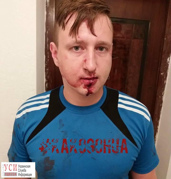 В Одессе неизвестные избили и ограбили журналиста «фото»