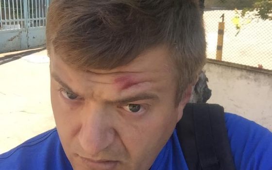 Избившие главу одесского “Автомайдана” напали на журналиста в Херсоне (фото) usionline.com Избившие главу одесского “Автомайдана” напали на журналиста в Херсоне (фото) «фото»