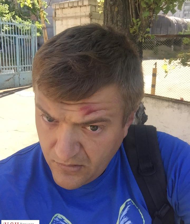 Избившие главу одесского “Автомайдана” напали на журналиста в Херсоне (фото) usionline.com Избившие главу одесского “Автомайдана” напали на журналиста в Херсоне (фото) «фото»