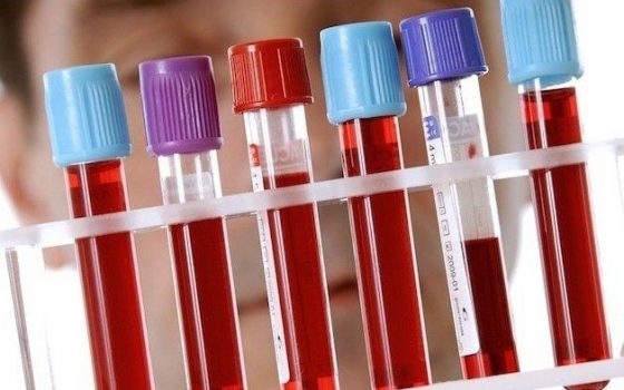 Каждый 24 обследованный одессит ВИЧ-положителен – медики «фото»