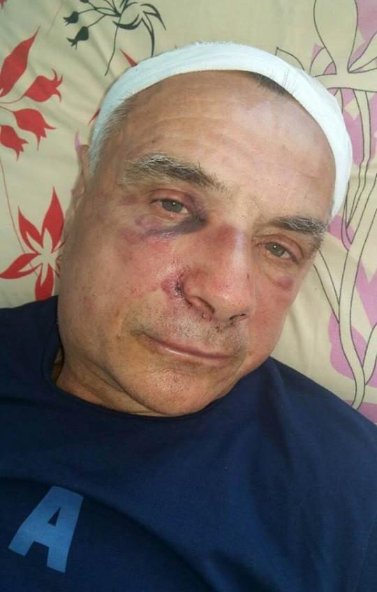 В Измаильском районе избили депутата Одесского облсовета (фото) «фото»
