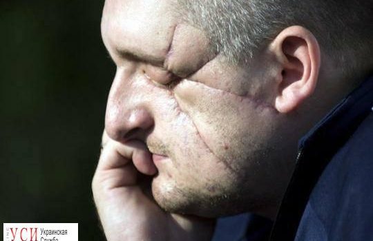 Непокоренные: “Я мрію, що винайдуть біонічні очі і я знову зможу побачити своїх доньок. Це буде останній крок до щастя” – Александр Дармороз usionline.com Непокоренные: “Я мрію, що винайдуть біонічні очі і я знову зможу побачити своїх доньок. Це буде останній крок до щастя” – Александр Дармороз «фото»