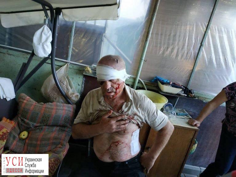 Домушника расстреляли из “травмата” в Киевском районе «фото»