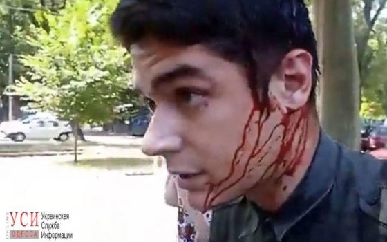 Задержанный по подозрению в покушении на активиста Устименко оказался военным «фото»