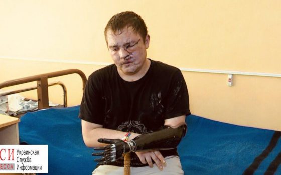 Непокоренные: “На мені не було живого місця. Я пережив дві клінічні смерті, вісім днів пролежав у комі та переніс більше сорока операцій – і вижив” – Евгений Редько «фото»