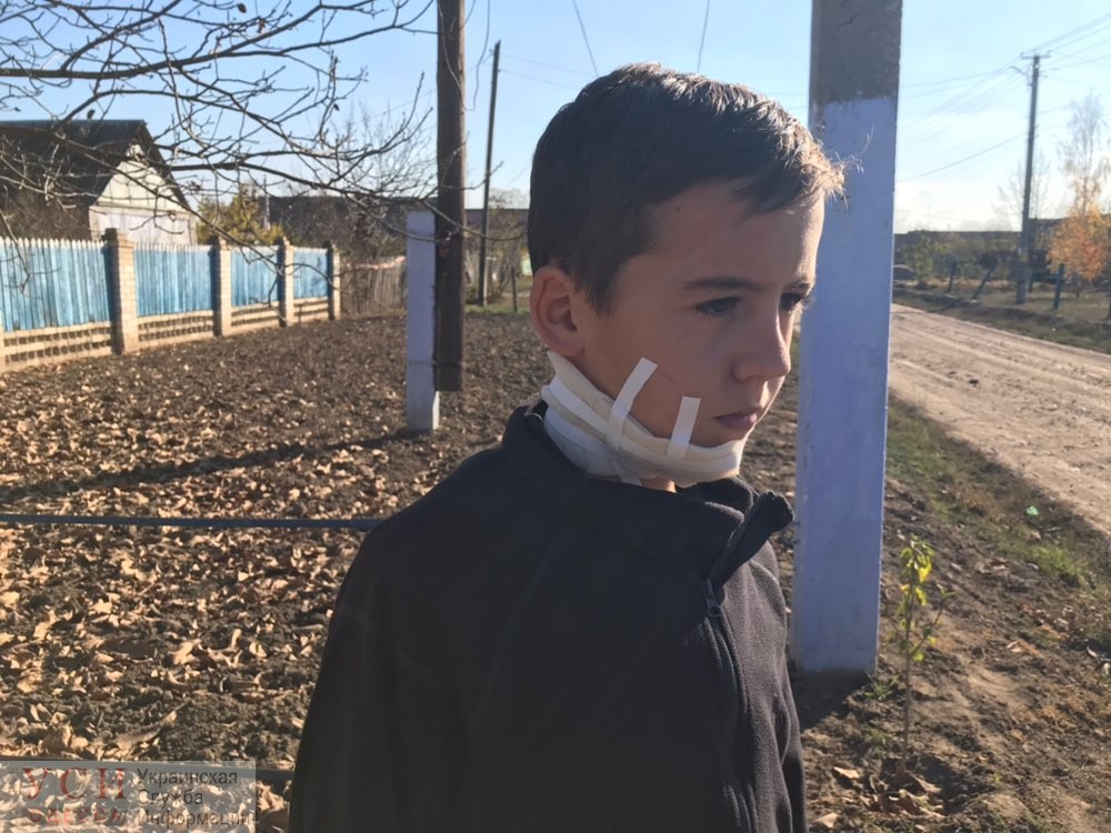 Подробности нападения на ребенка под Одессой: мужчина порезал шею племянника и обещал сжечь дом вместе с детьми (фото 18+) «фото»