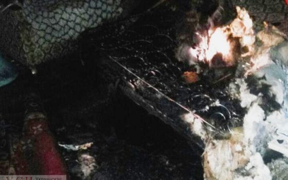 Пенсионерка получила сильные ожоги во время пожара в квартире на Семинарской (фото) «фото»