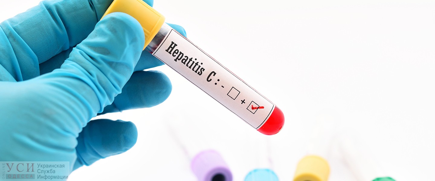 В Одесской области трое детей заболели гепатитом «фото»