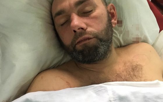 Одесситов просят помочь установить личность мужчины, попавшего в больницу в коме (фото) usionline.com Одесситов просят помочь установить личность мужчины, попавшего в больницу в коме (фото) «фото»