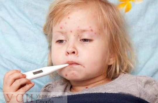 В Килийском районе ввели карантин: количество заболевших корью стремительно растет «фото»