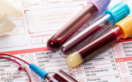 Одесситы, подписавшие декларацию с семейными врачами, смогут бесплатно сдавать анализы «фото»