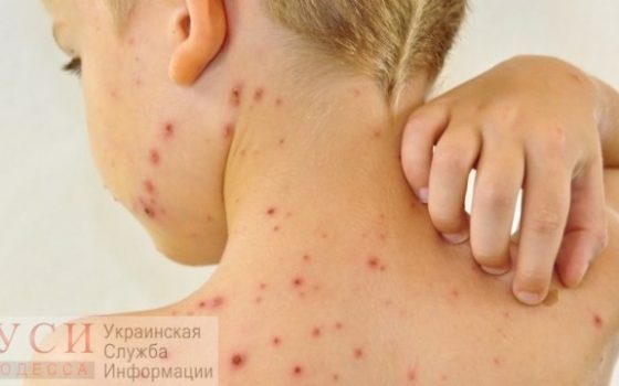 Родители полсотни детей, заболевших корью в Килийском районе, отказались от прививок из-за религии (фото) ОБНОВЛЕНО «фото»