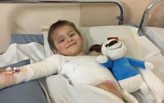 Двоих детей, которые ошпарились кипятком для стирки, госпитализировали с сильными ожогами в одесскую больницу (фото) «фото»