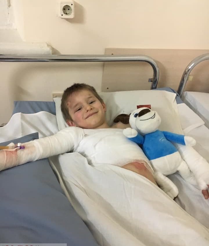 Двоих детей, которые ошпарились кипятком для стирки, госпитализировали с сильными ожогами в одесскую больницу (фото) «фото»