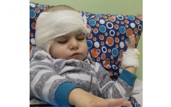 Операция прошла хорошо: еще один маленький подопечный одесских волонтеров получил шанс слышать «фото»