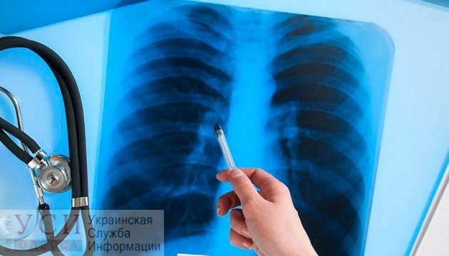 В школах Черноморска зафиксировали заболевания туберкулезом: диагноз подтвердили учителю одной из школ (видео) «фото»