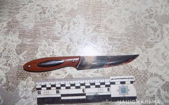 Пациент измаильской больницы убил соседа по палате из-за громкой музыки из колонок (фото, видео) «фото»